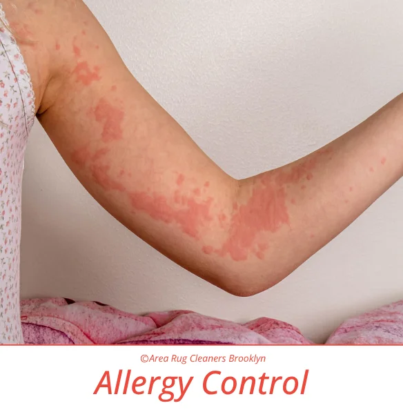 Allergy Control